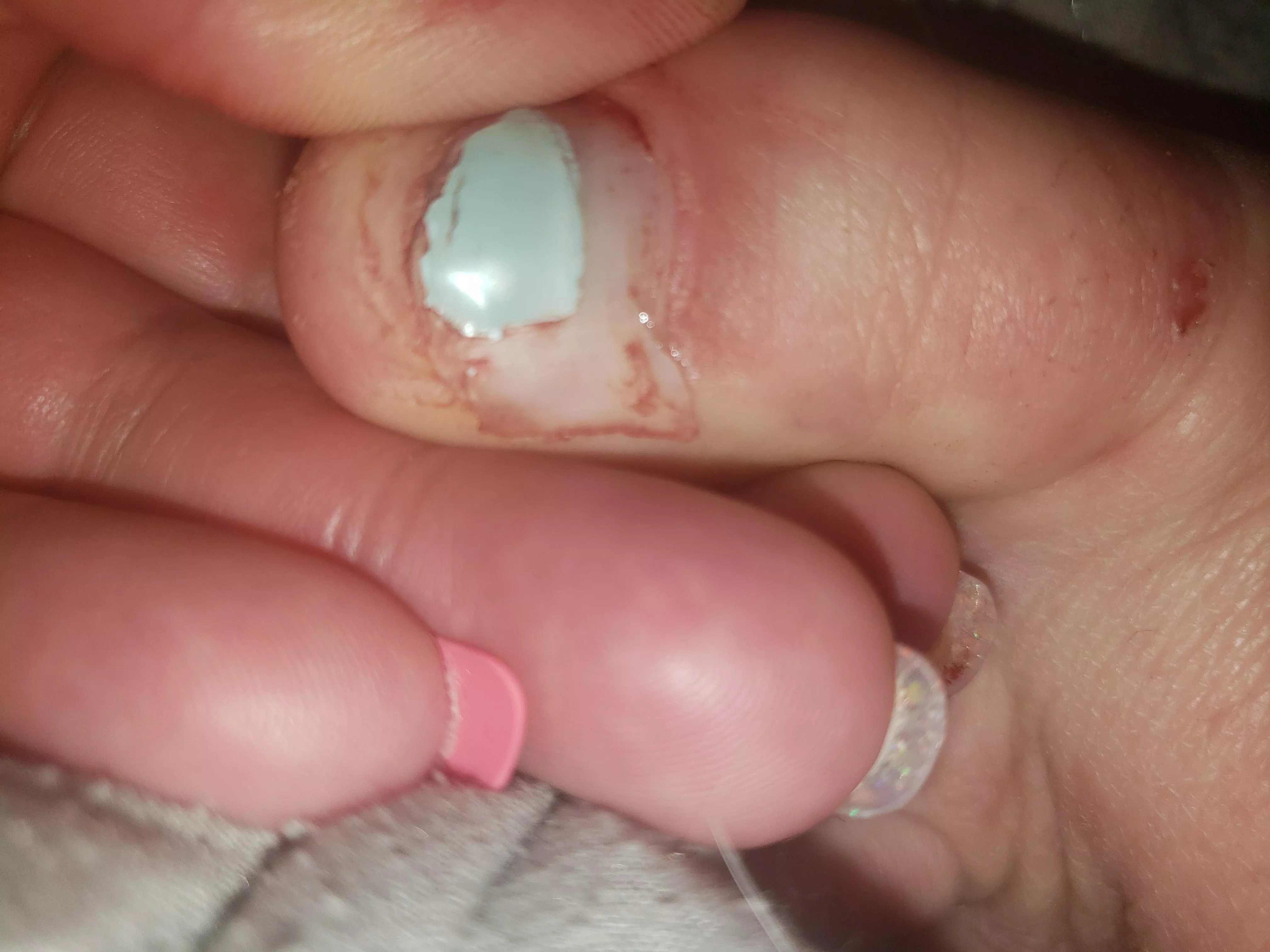 I've been gently messing with this toenail for two days and finally got it out. Now I don't know what to do with it.