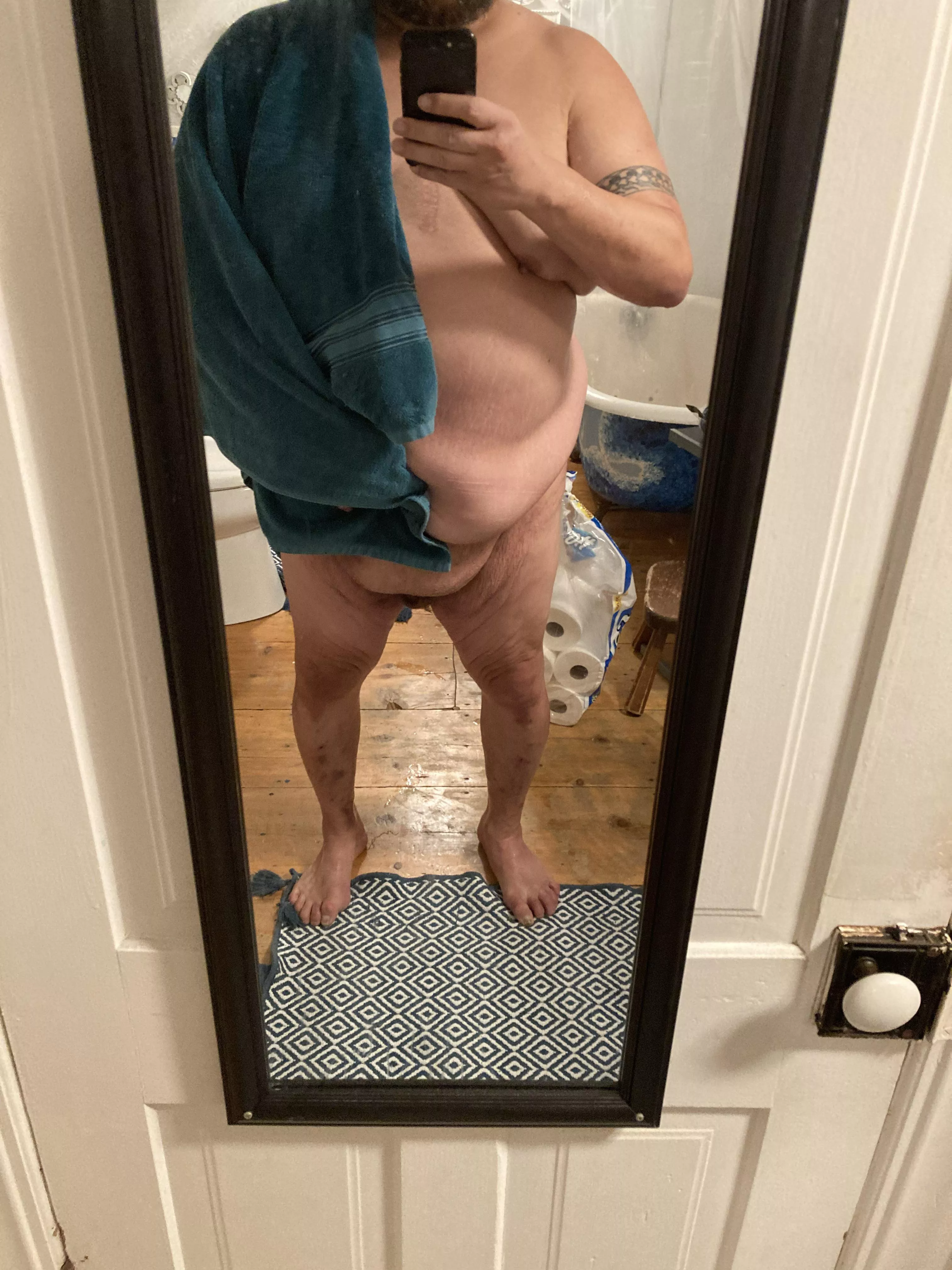 I’ve lost over 100 lbs, with 100 more to go. I’m so embarrassed with my body. Hate how fat covers my penis. When I hit goal weight, I’ll get skin surgery. I’m documenting to hopefully see you all in a year or so.
