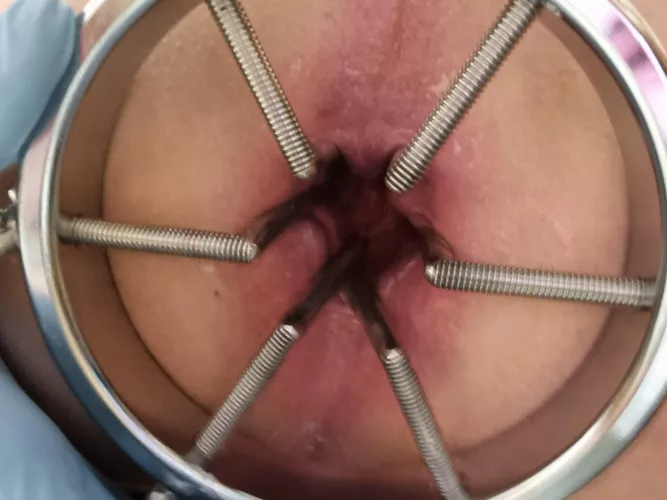 Just a few more turns....