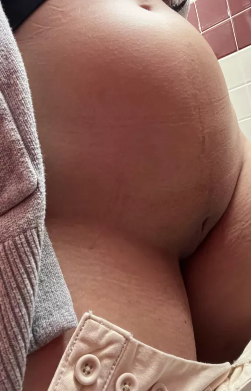 Just a little bump