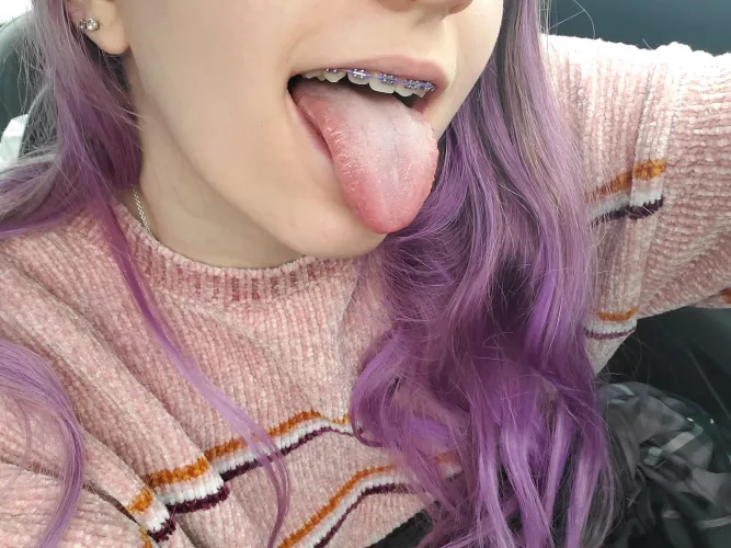 just got my braces color changed to purple 💜