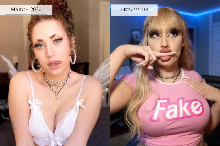 Just got some fresh cheek and lip filler 🥰 (oc)