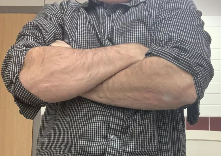 Just some dad forearms Just some dad forearms