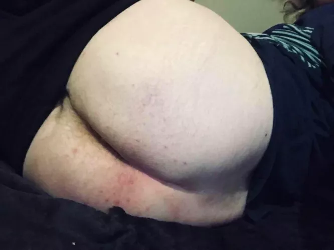 Just some fat cheeks.