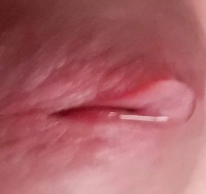 Just the tip Just the tip