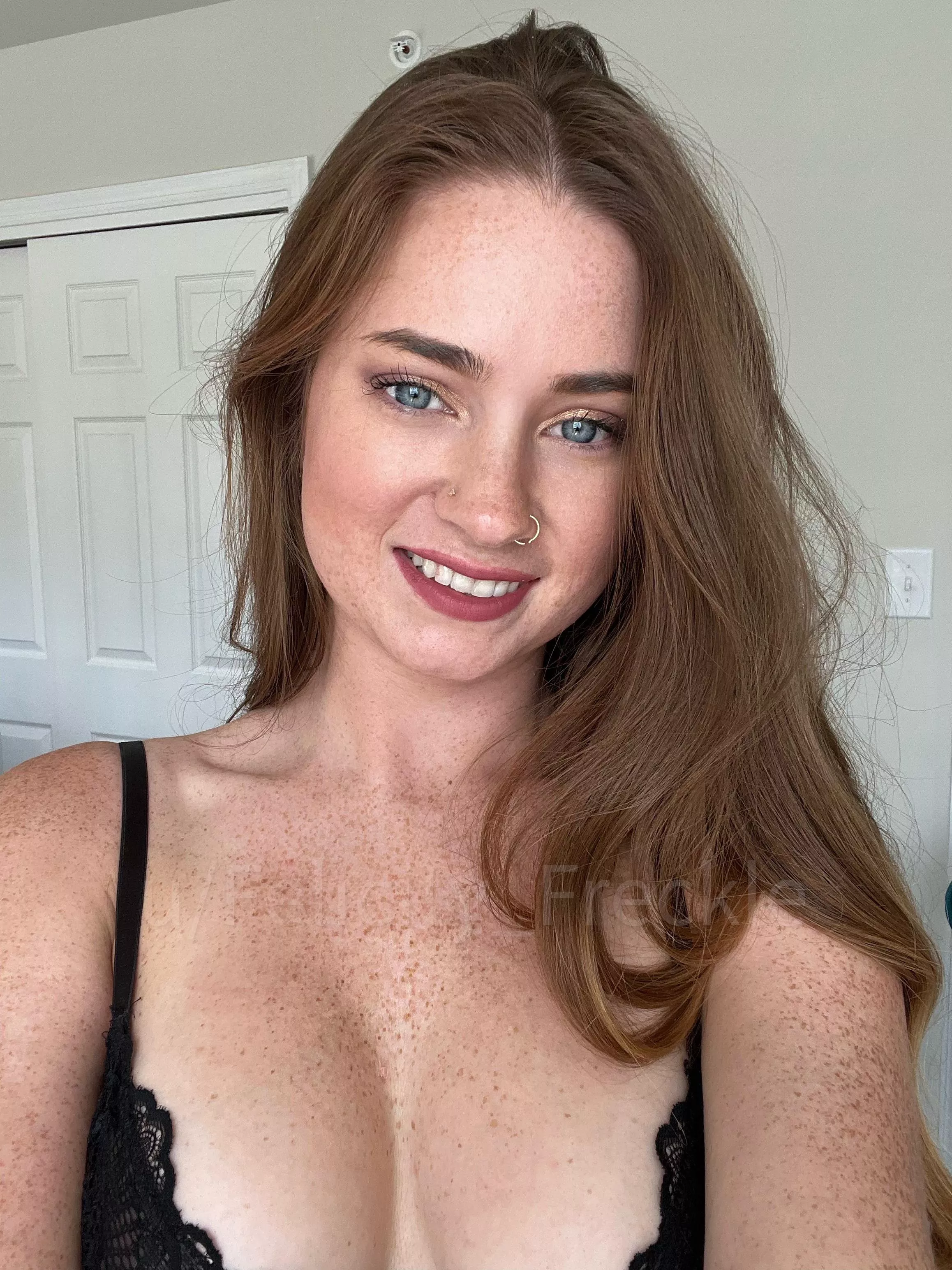 Kiss my freckles? Kiss my freckles?