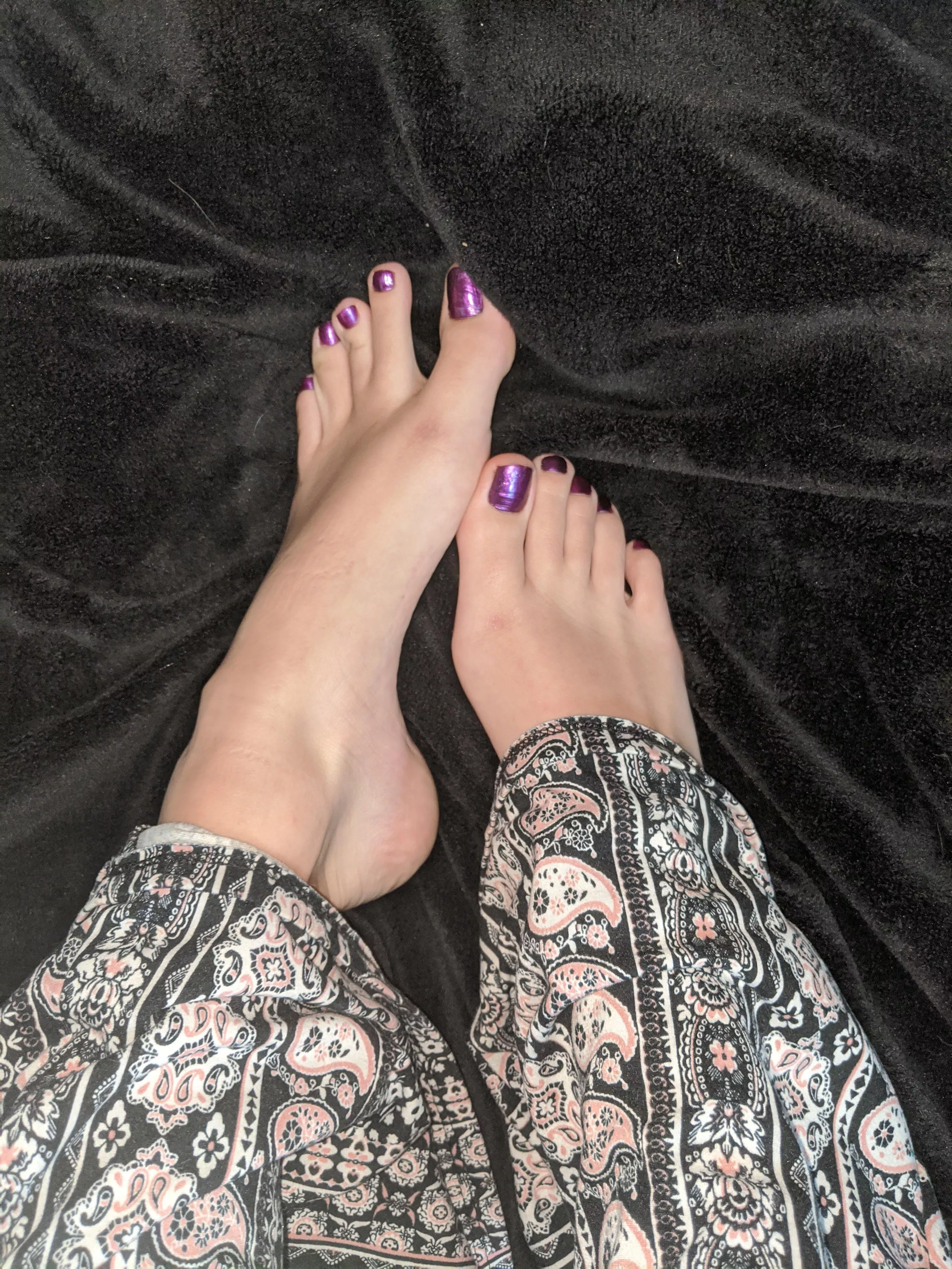 kiss them kiss them