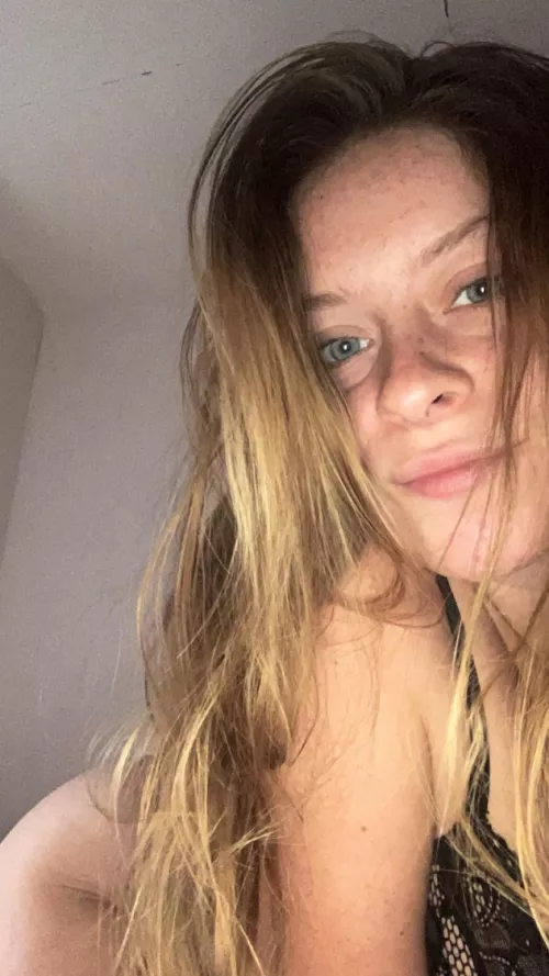 learning to love my freckles