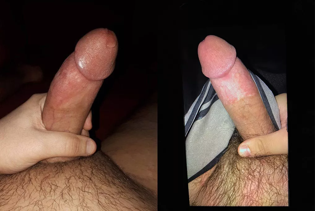 Left or right? Left or right?