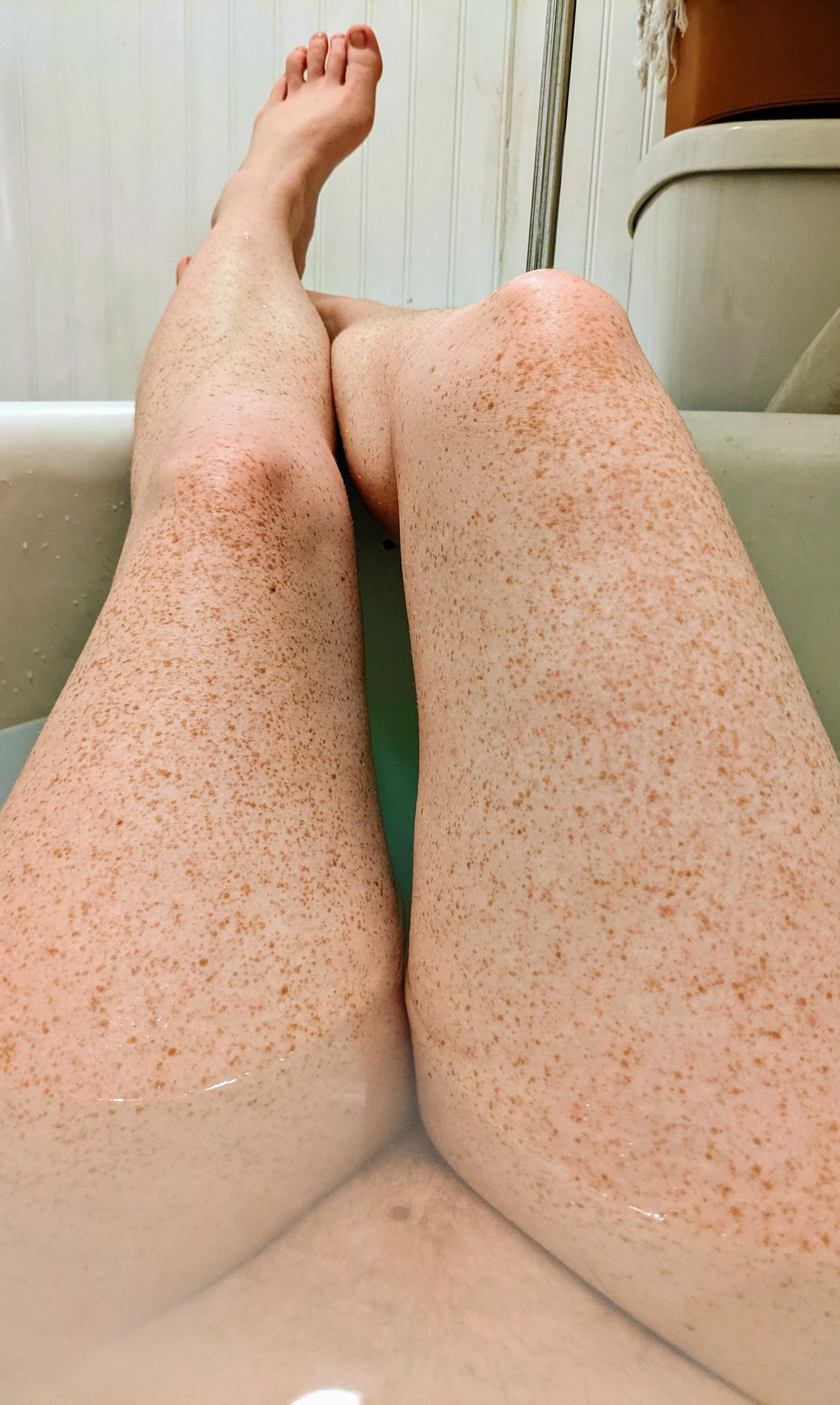 Leftover frecks from a summer of short shorts. Leftover frecks from a summer of short shorts.