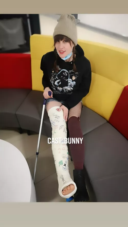 Long socks + long leg cast 🌟🤩