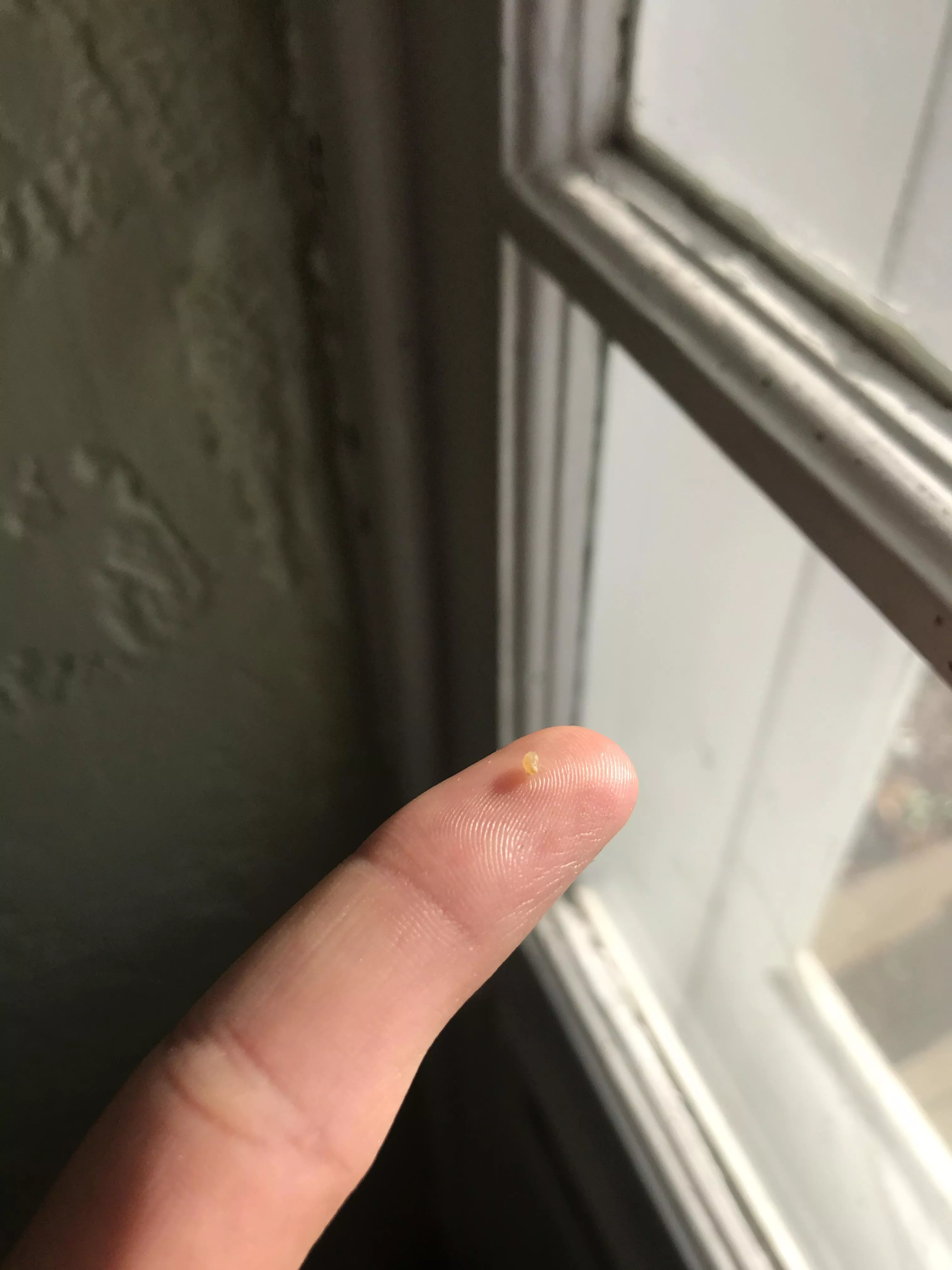 Long time lurker, first time poster. Dug this guy out of the side of my nose over the course of 6-ish months