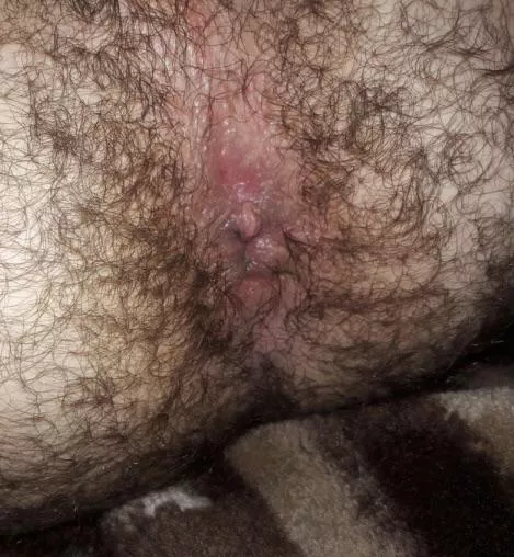 Looking for other hairy smelly dudes who can appreciate my musky hairy butthole
