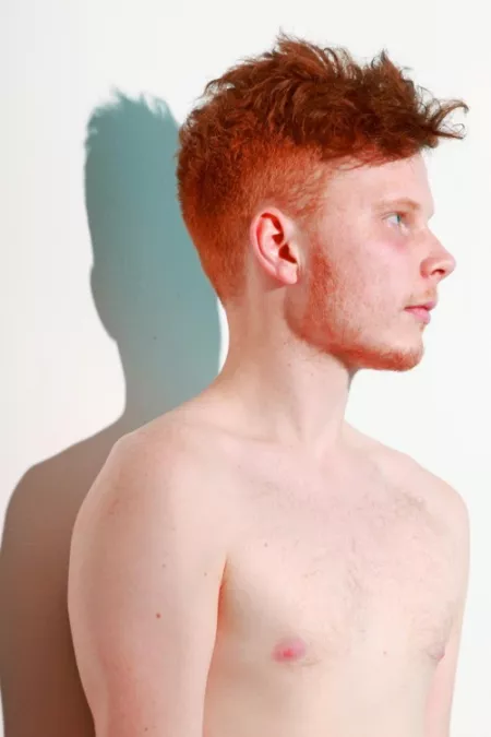 Naked Albino Men Naked Albino Men