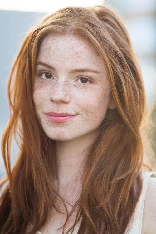 Lots of freckles