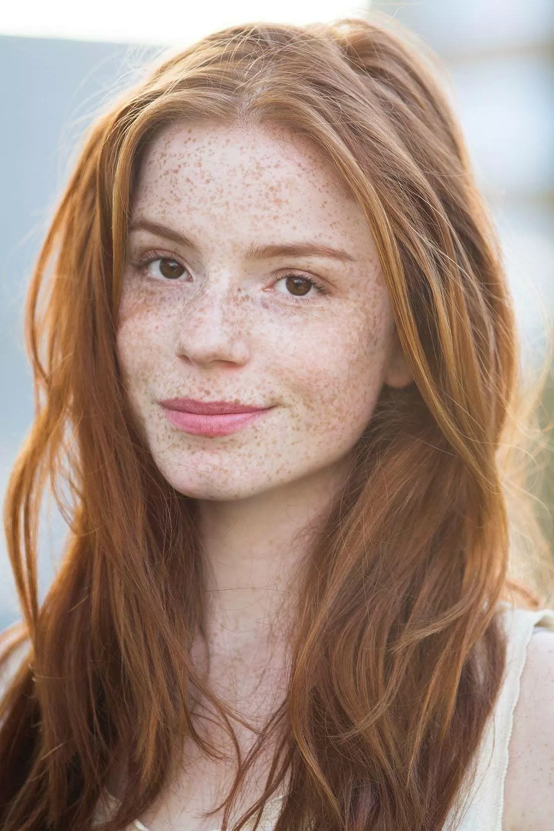 Lots of freckles
