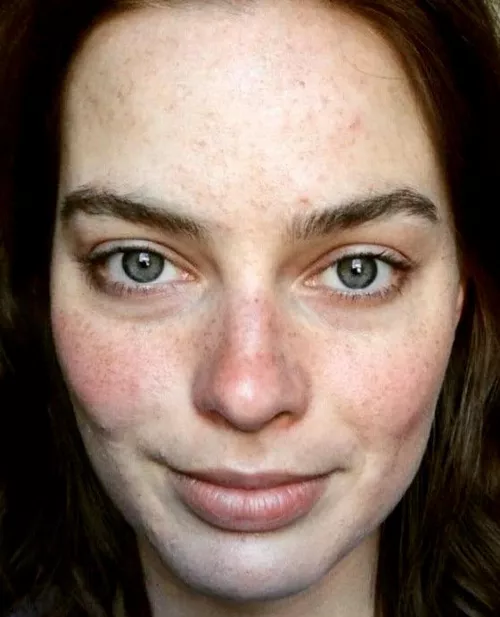 Margot Robbie without makeup is still beautiful 😍 Margot Robbie without makeup is still beautiful 😍