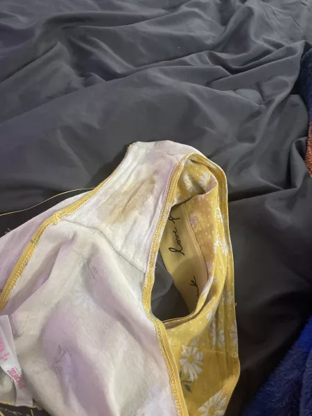 Marks like this means I hit the gym hard! DM me if interested!