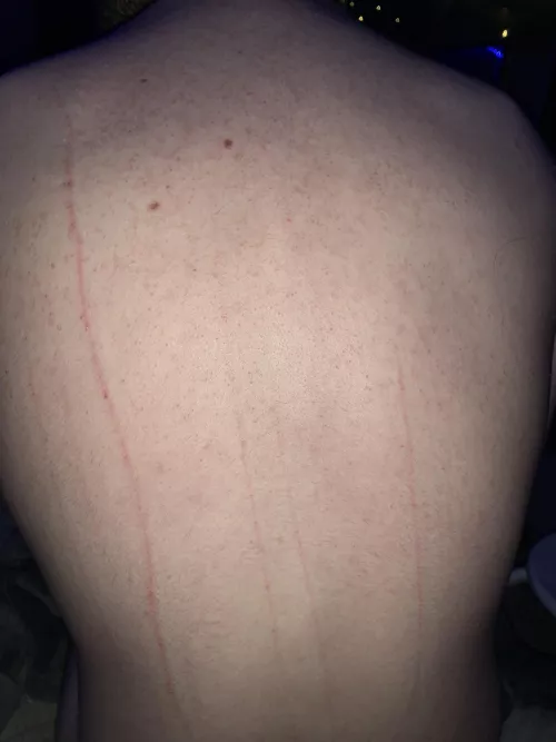 Master didn’t draw blood 😣 maybe they’ll grant me it next time