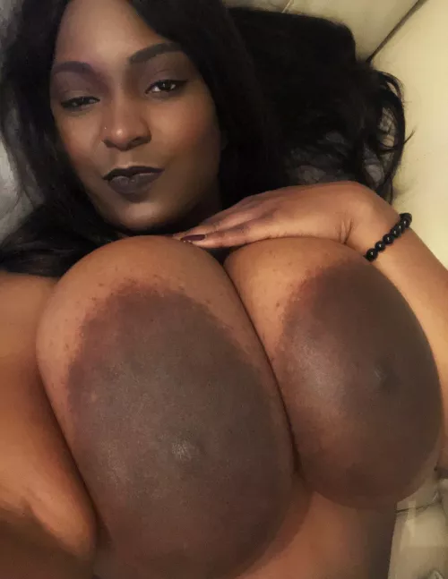 Mega Areolas