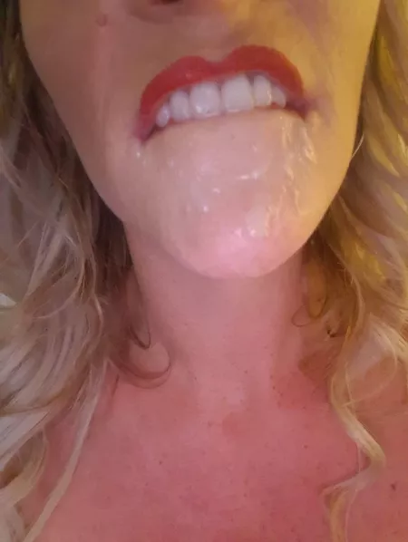 Messy lip bite ?