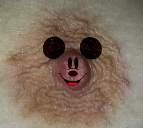 Mickey nips.... Mickey nips....