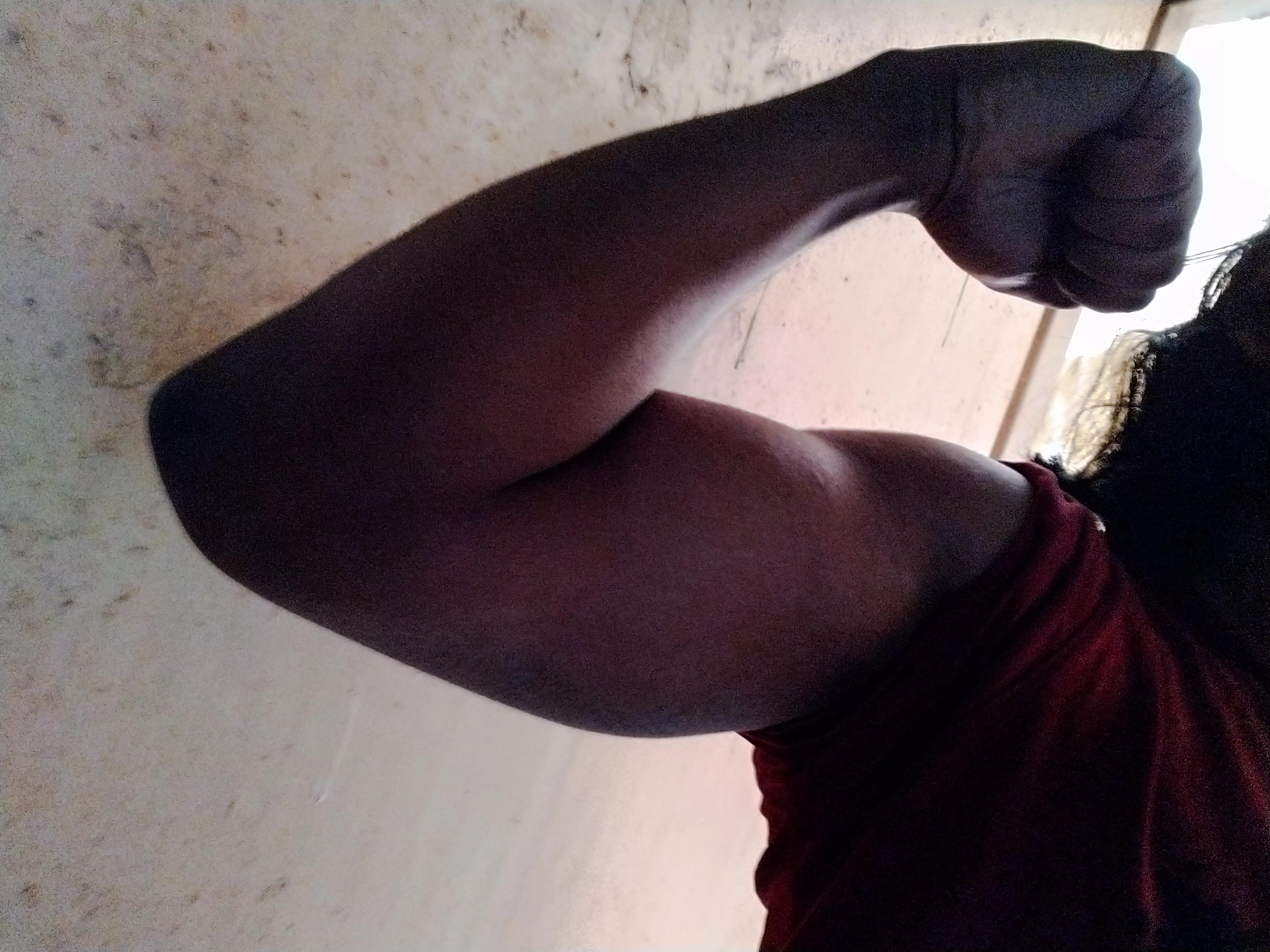 Mine got bulky without veins, will the society accept me?