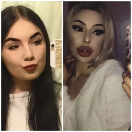 my 3years transformation🔥boobs surgery➡️9.07 STILL IN PROGRESS👸🏼💋