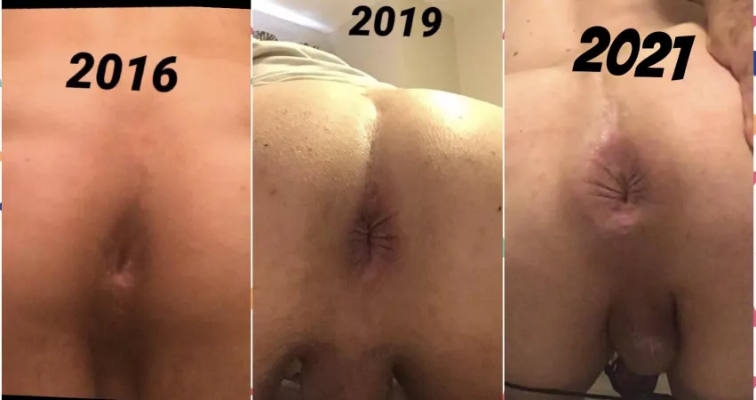 My asshole being forever destroyed year after year My asshole being forever destroyed year after year