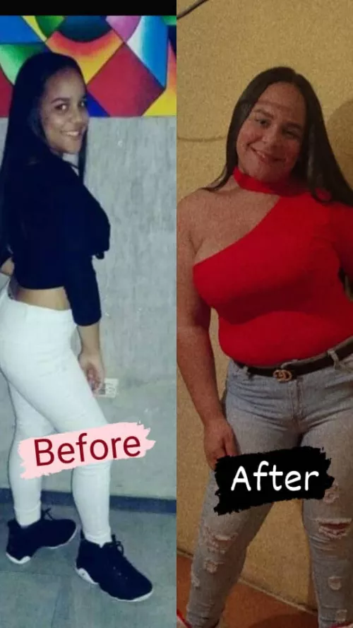 my before and after is amazing I hope your comments please and those who can follow me I appreciate it I need to upload more and more I love being chubby 🐷🤩