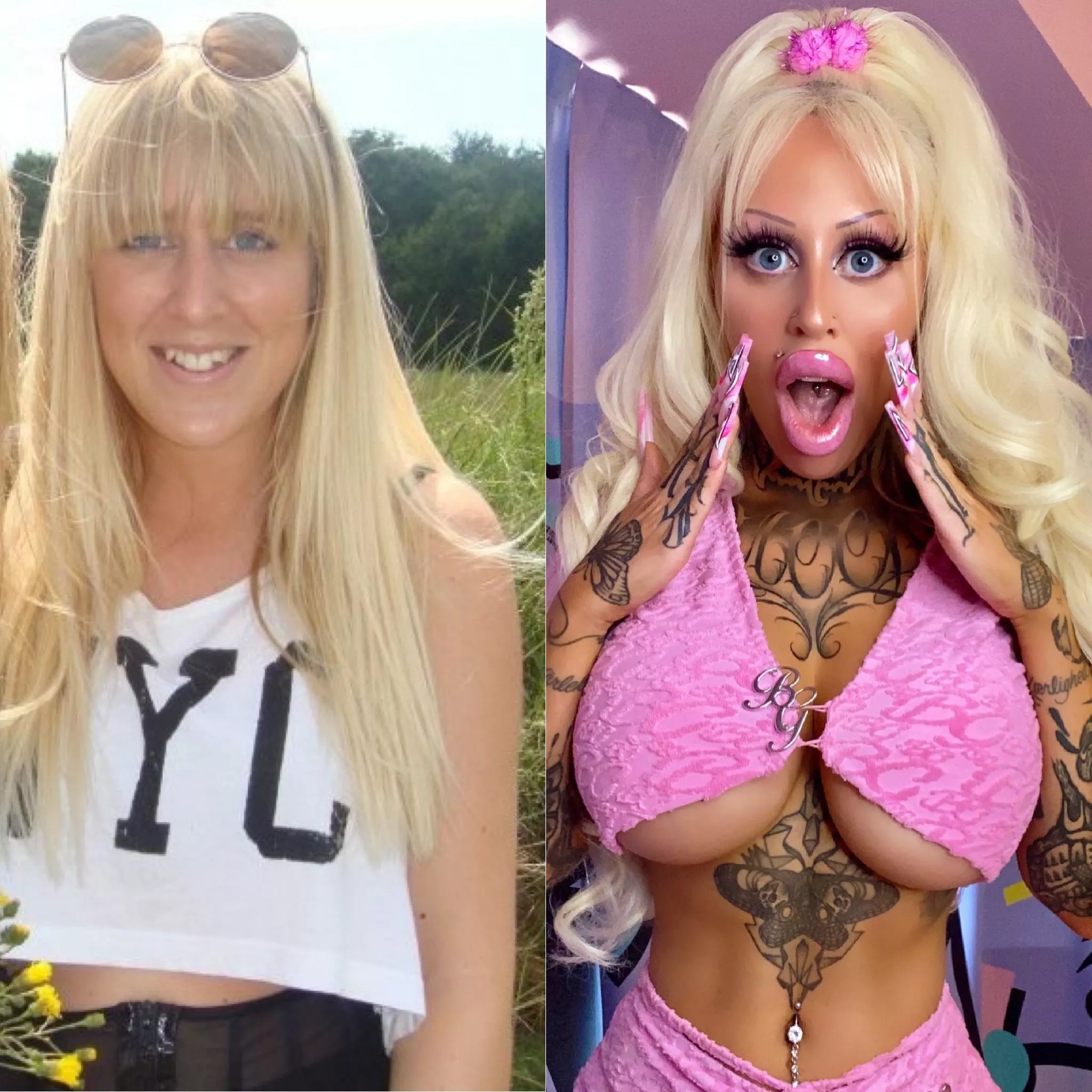 My Bimbofication. Next up: expander breast implants 💕💕