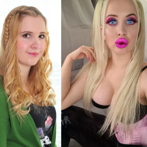 My bimbofication so far π More fillers in 2 days, expanders spring 2022 π₯°