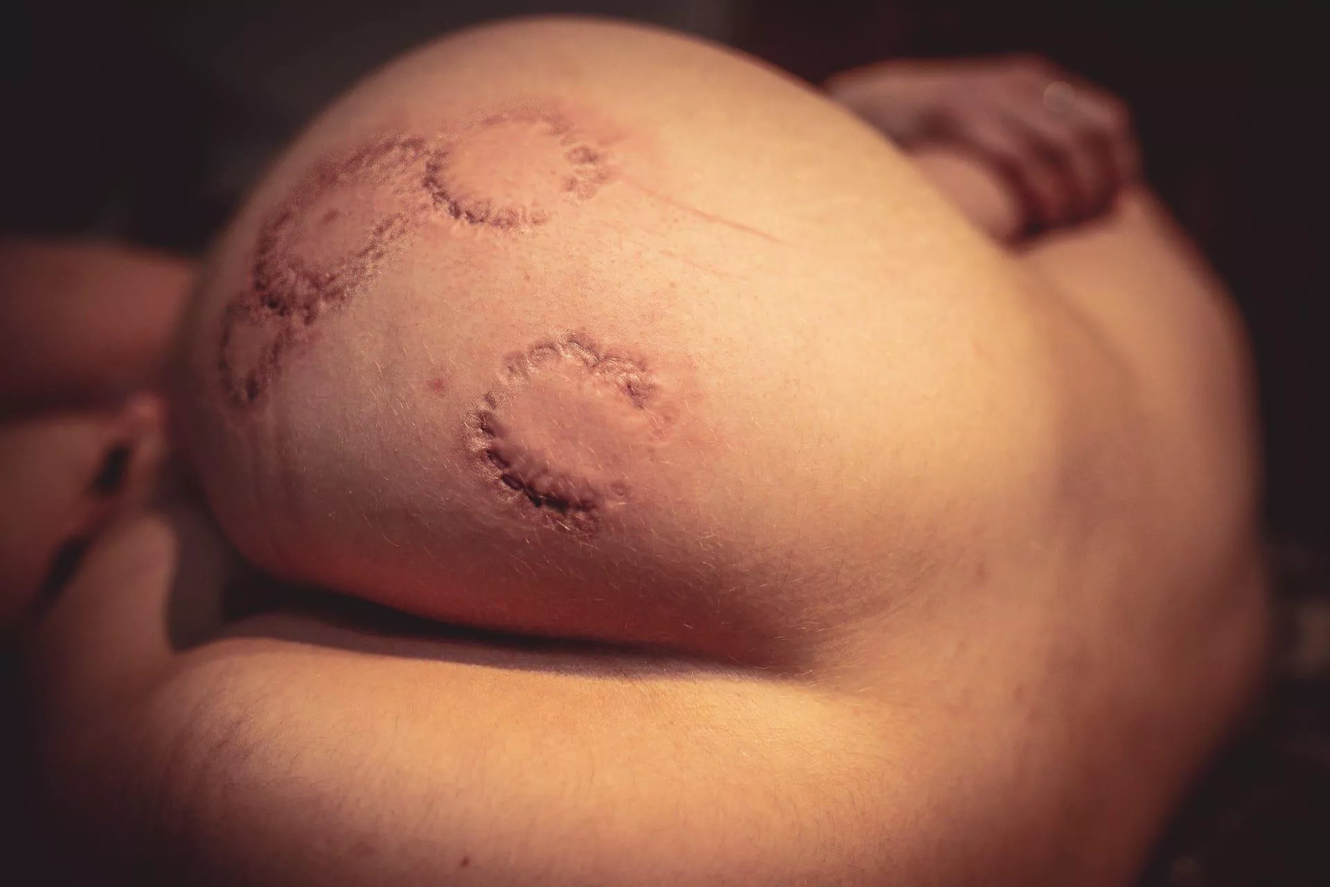 My dom likes to bite my little but ?