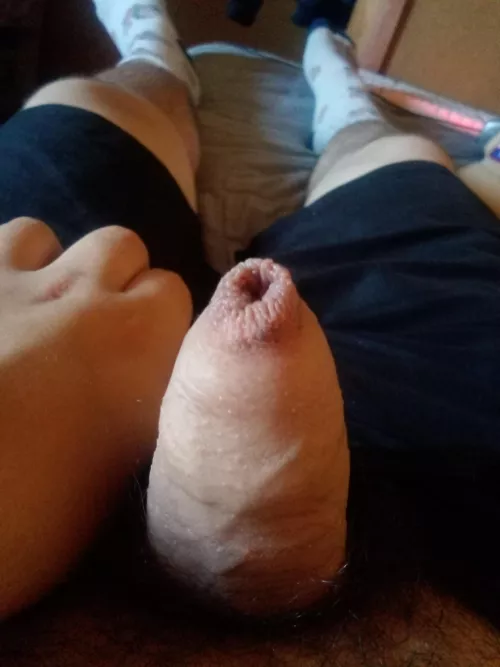 My foreskin [24]