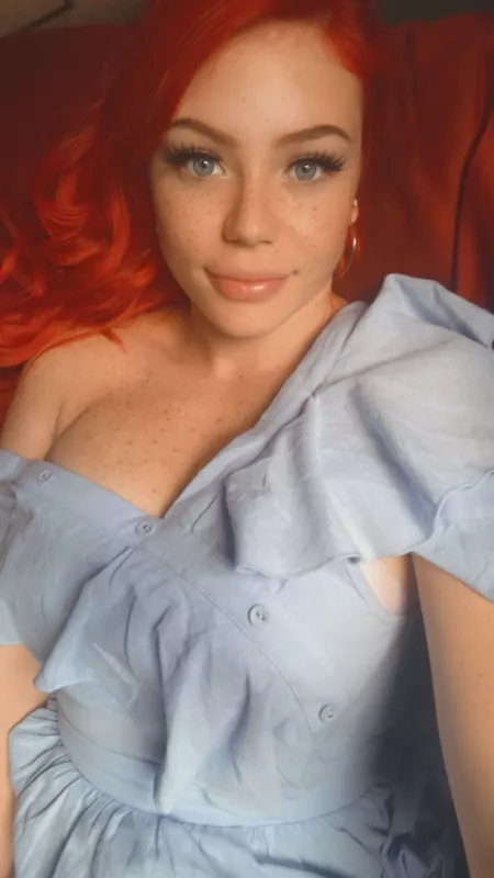 My freckles ๐๐๐ My freckles ๐๐๐