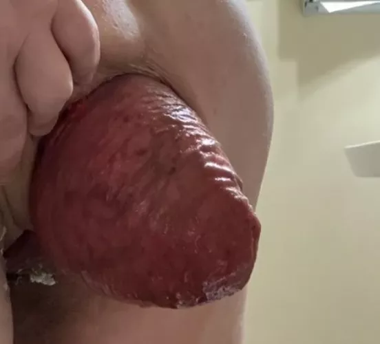 My giant prolapsed hole. My giant prolapsed hole.