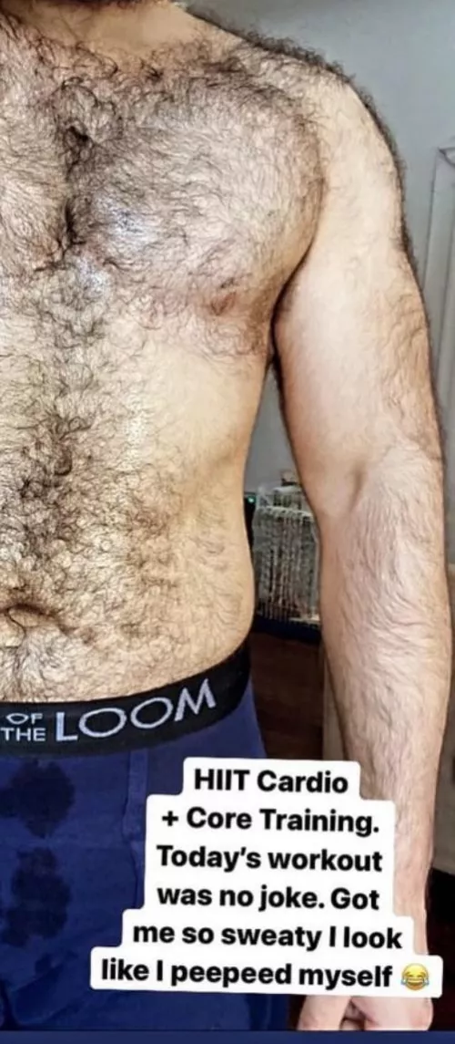 My Hairy Arm My Hairy Arm