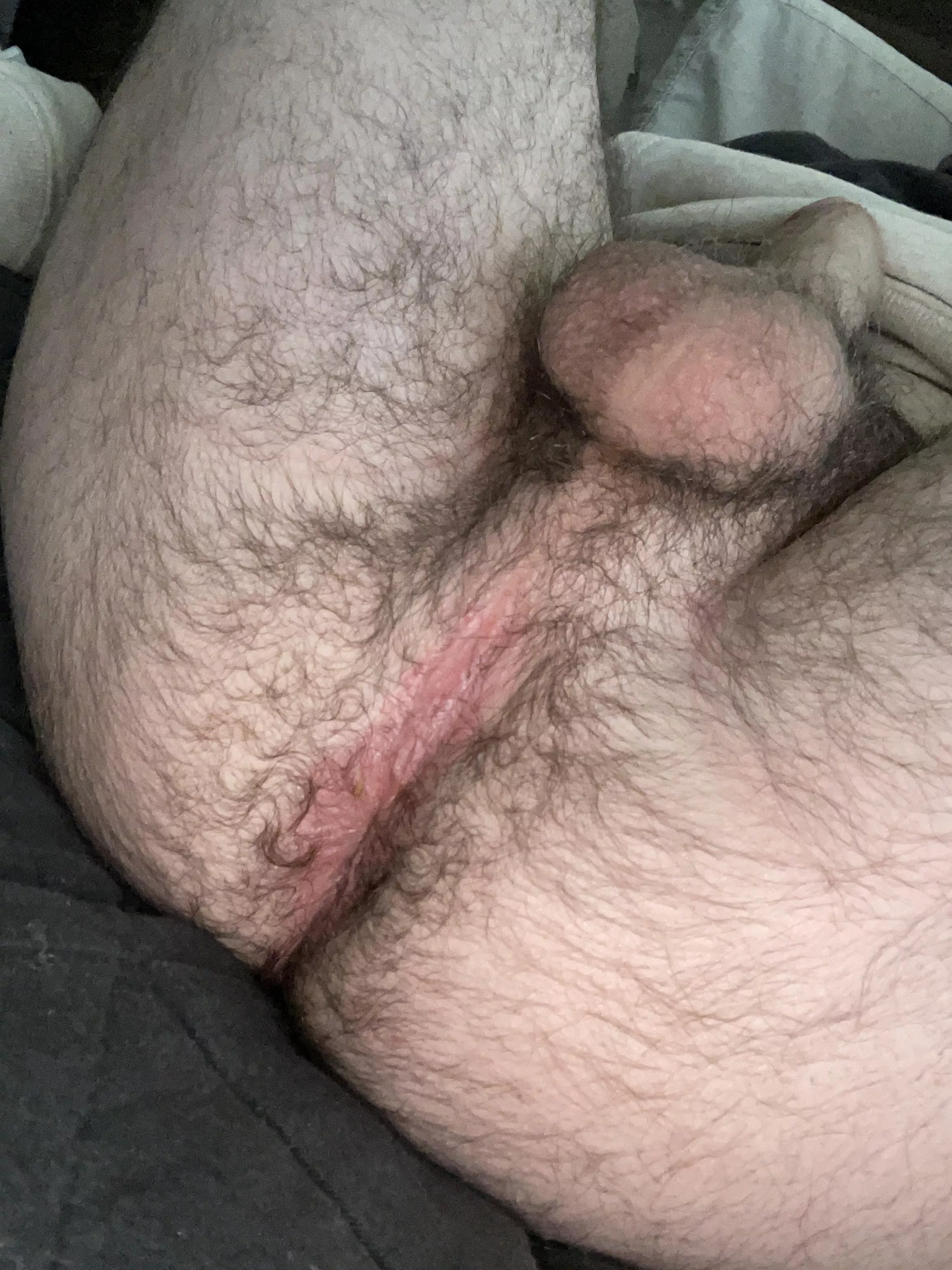 My Hairy Ass And Balls Anyone Wanna Taste Nudes Hairymanass Nude