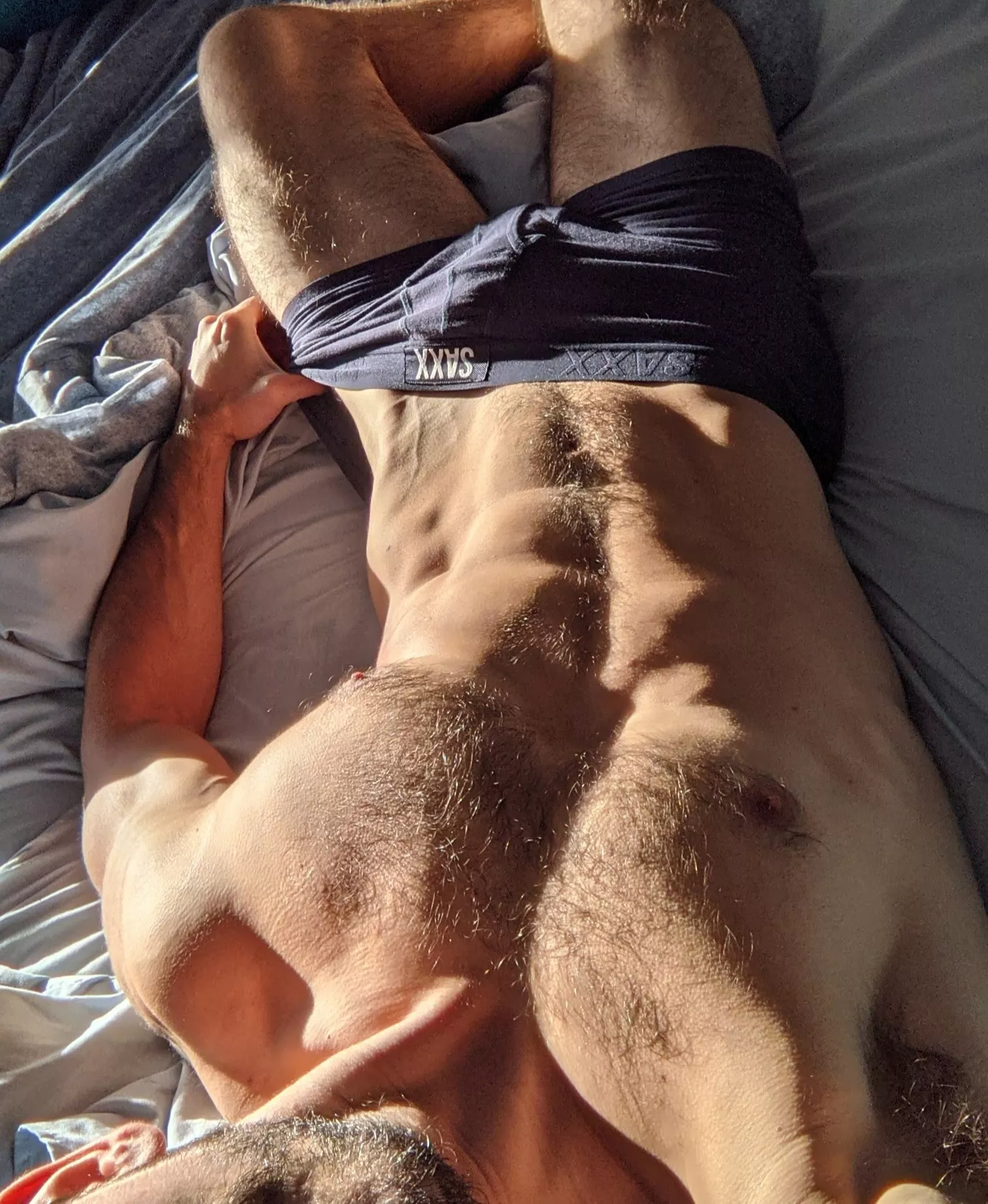 My Hip (veins) Don't Lie My Hip (veins) Don't Lie