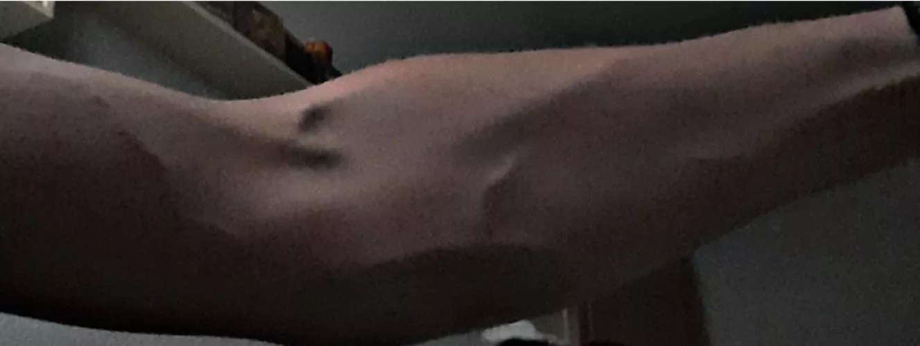 My hot skinny arms ๐ My hot skinny arms ๐
