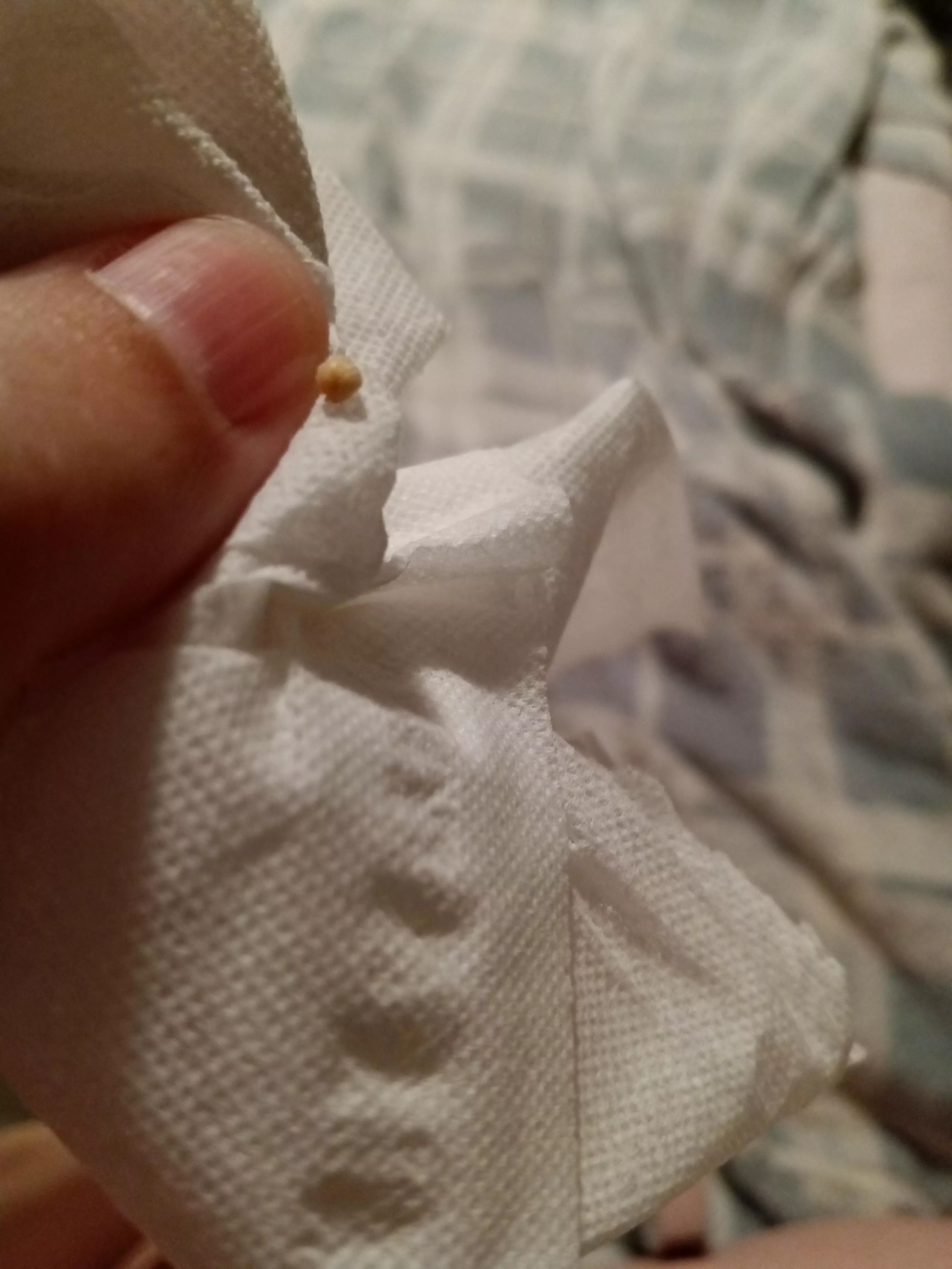 My husband got this milia/skin pearl off of me and told me to share it because it was so big 😭