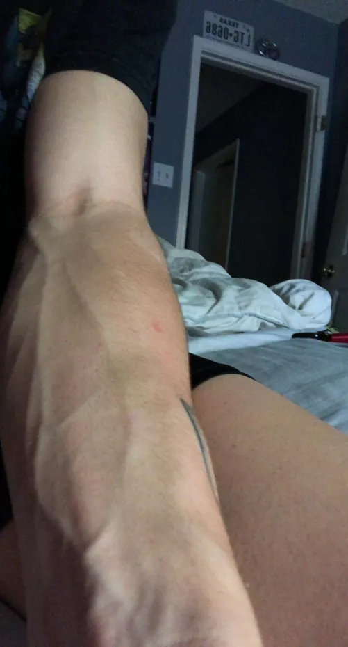 my resting arm my resting arm