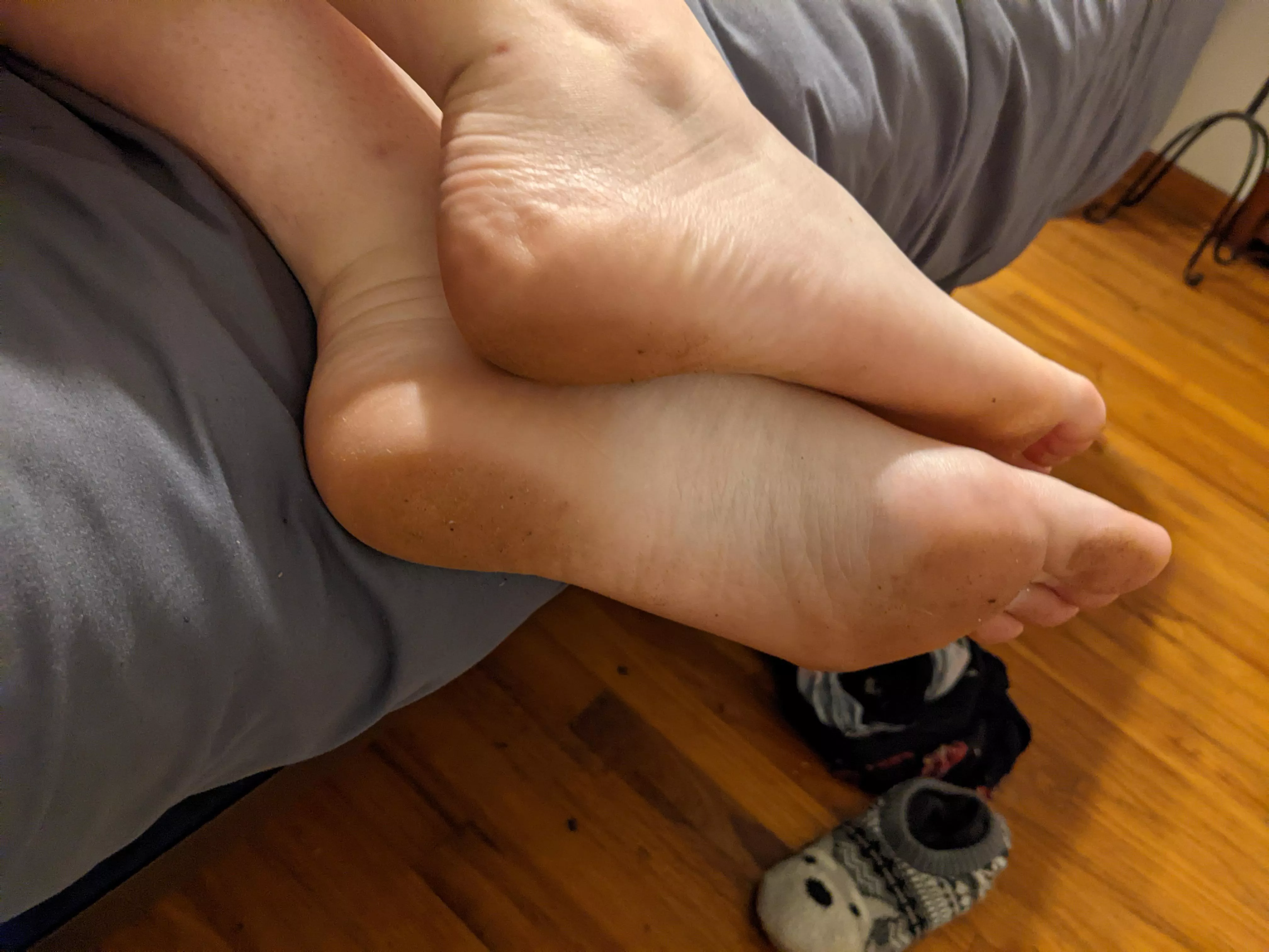My tiny soles need attention ❤️