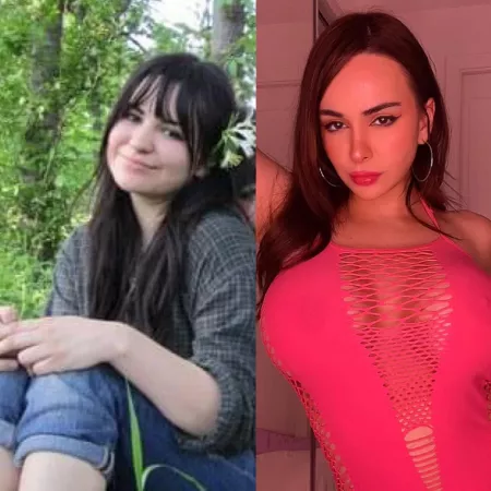 my transformation so far π this monday iβm getting my lips done!! woo!!