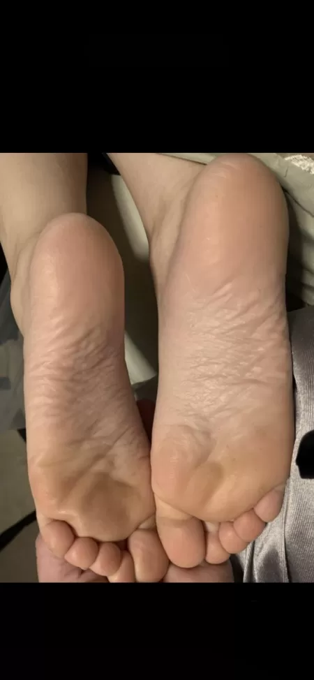My wifeβs wrinkly soles