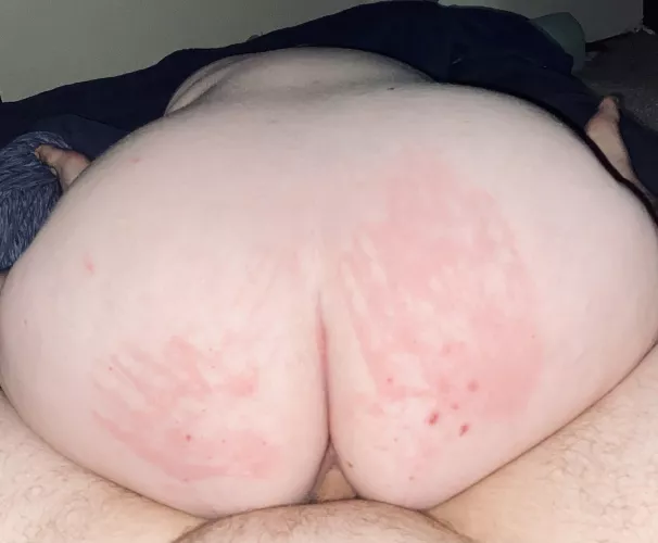 Need more hands. 🔥🔥