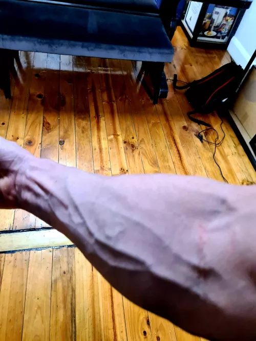 Need more veins. Need more veins.