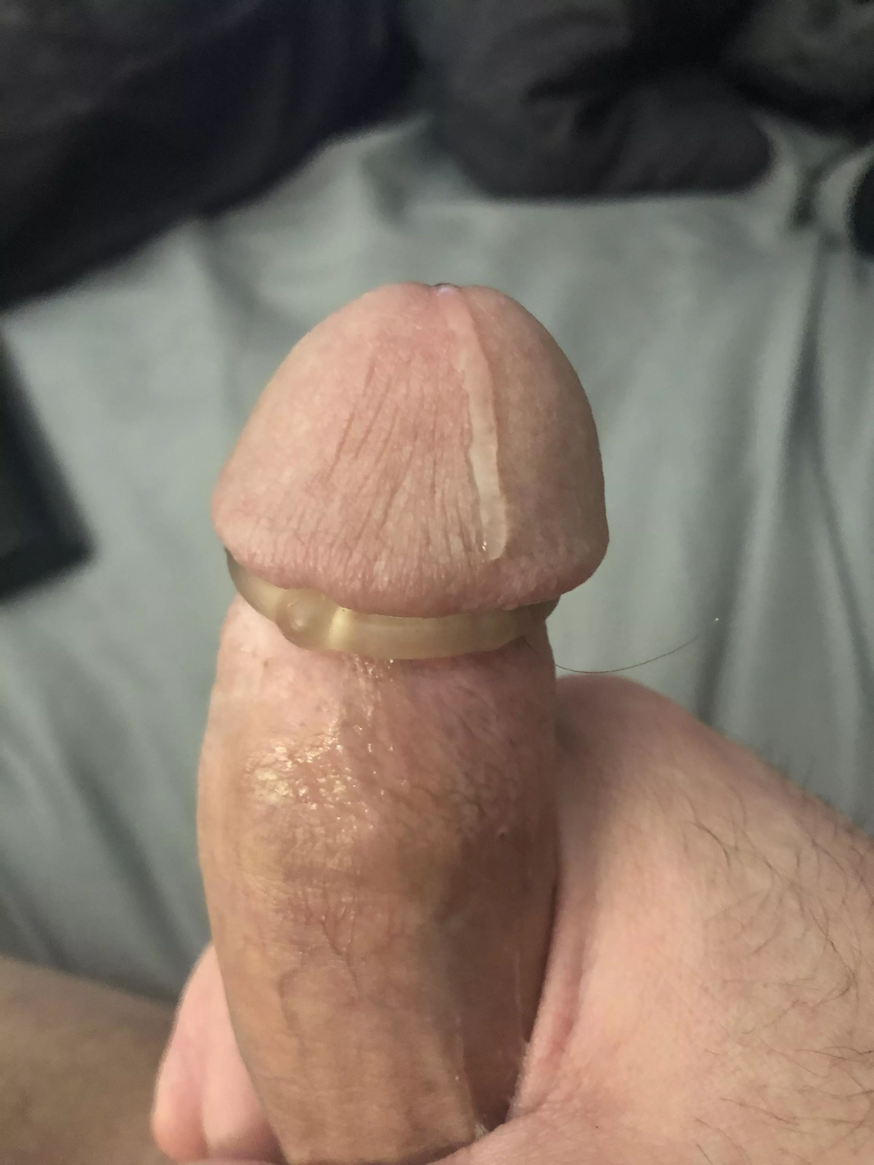 Needs attention π§ Needs attention π§