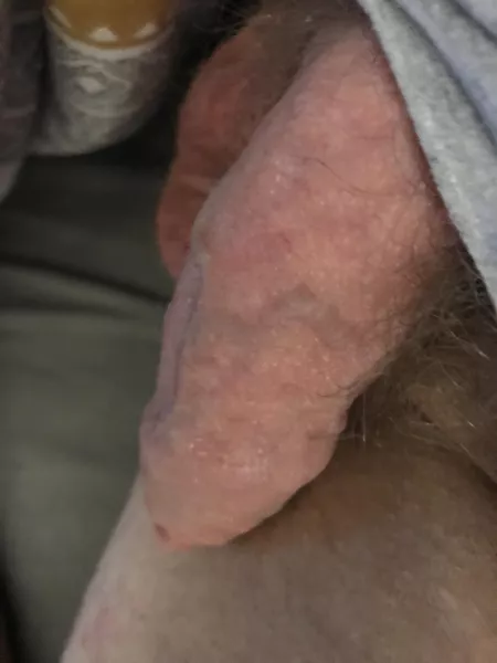 Needs making hard