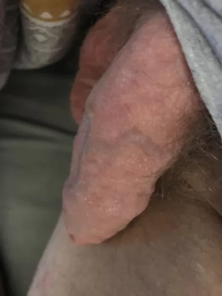 Needs making hard